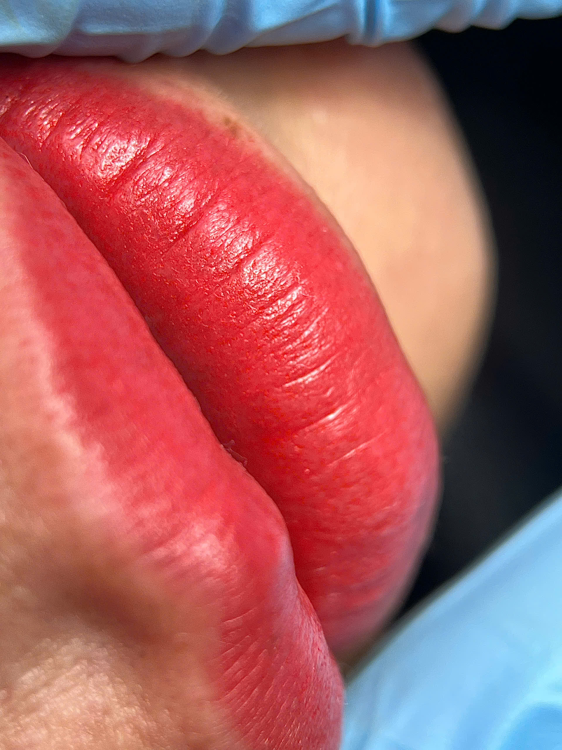 Phun xăm môi Collagen