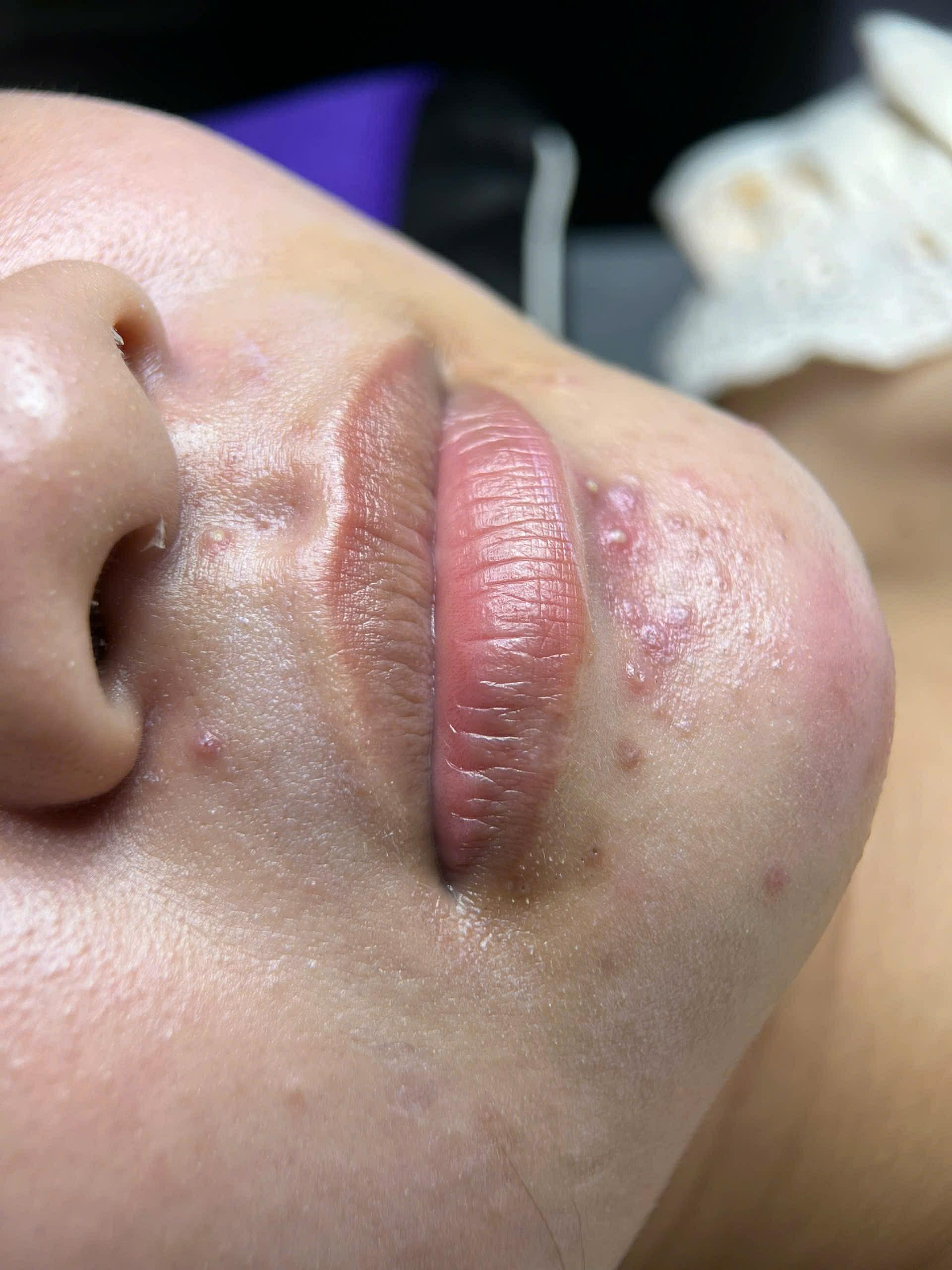 Phun xăm môi Collagenc